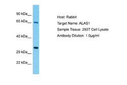 Alas1 Antibody, Novus Biologicals 100 &mu;L | Buy Online | Novus Biologicals | Fisher Scientific